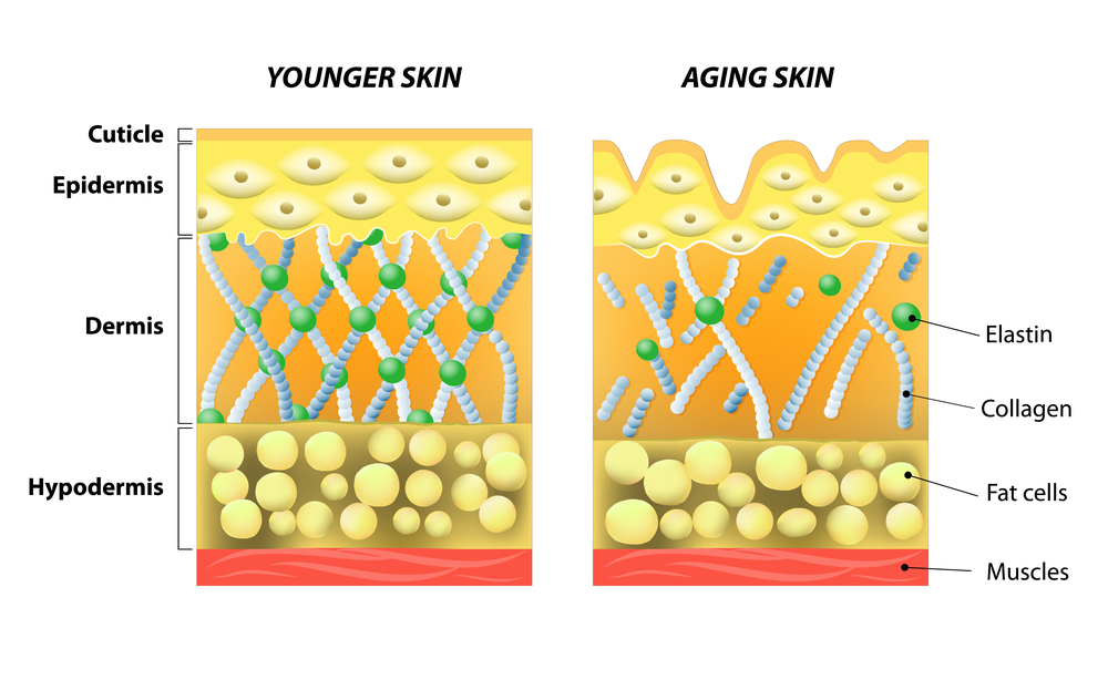 Improving Skin Thickness And Elasticity Dr Alex Chambers Medical Improving Skin Thickness And Elasticity Dr Alex Chambers Medical